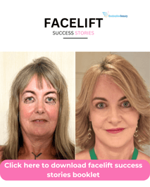 download facelift booklet